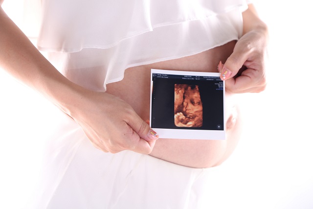 【未婚？既婚？】現在の状況別・夢占い５選