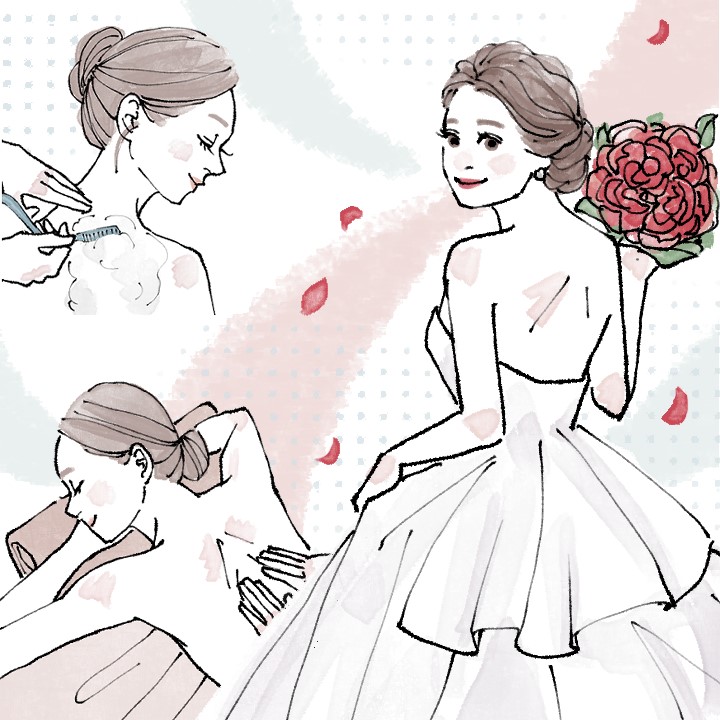 エステを受け理想の花嫁姿に