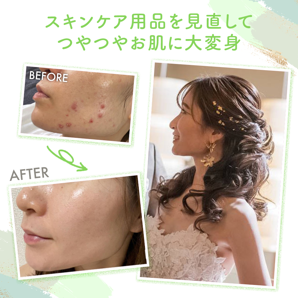 skincareのBEFORE・AFTER画像