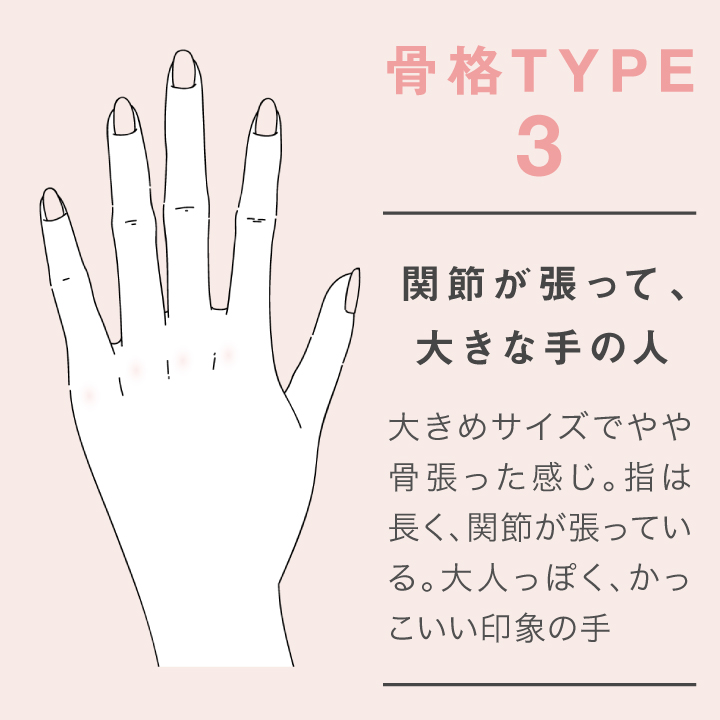 type３